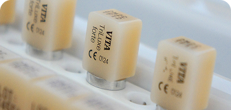 wackerbeck-mueller-leistungen-cerec-teaser