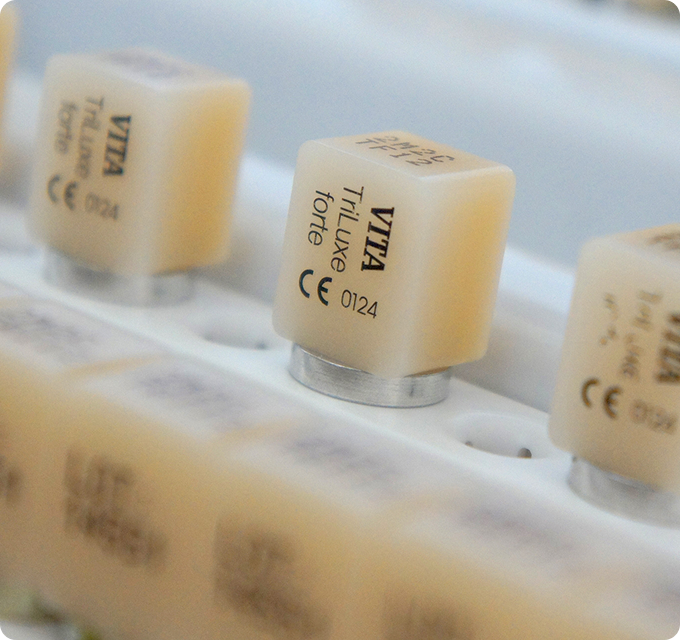 wackerbeck-mueller-leistungen-cerec