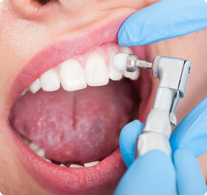 wackerbeck-mueller-leistungen-prophylaxe